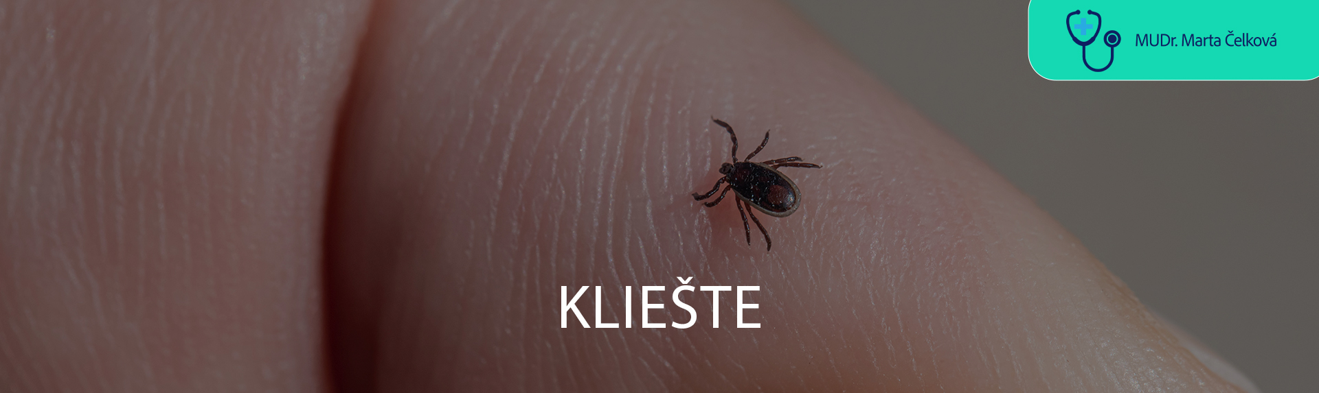 Kliešte